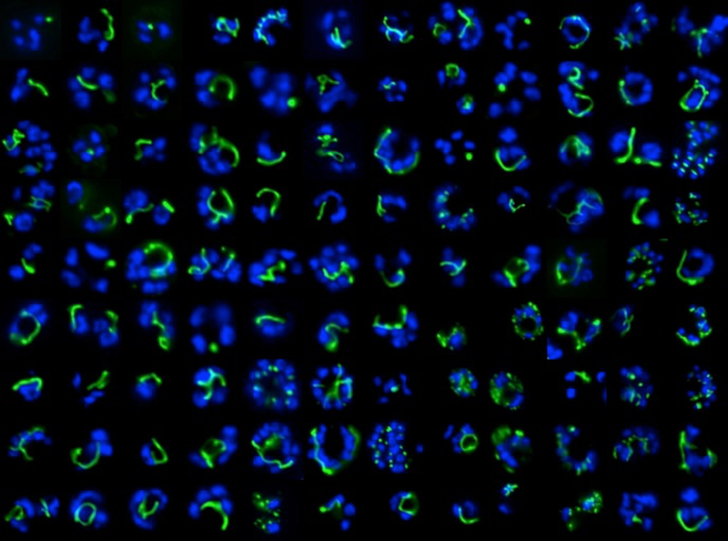 Epifluorescence microscopy of the Plasmodium apicoplast organelle during elongation and branching (green = apicoplast, blue = dividing nuclei)